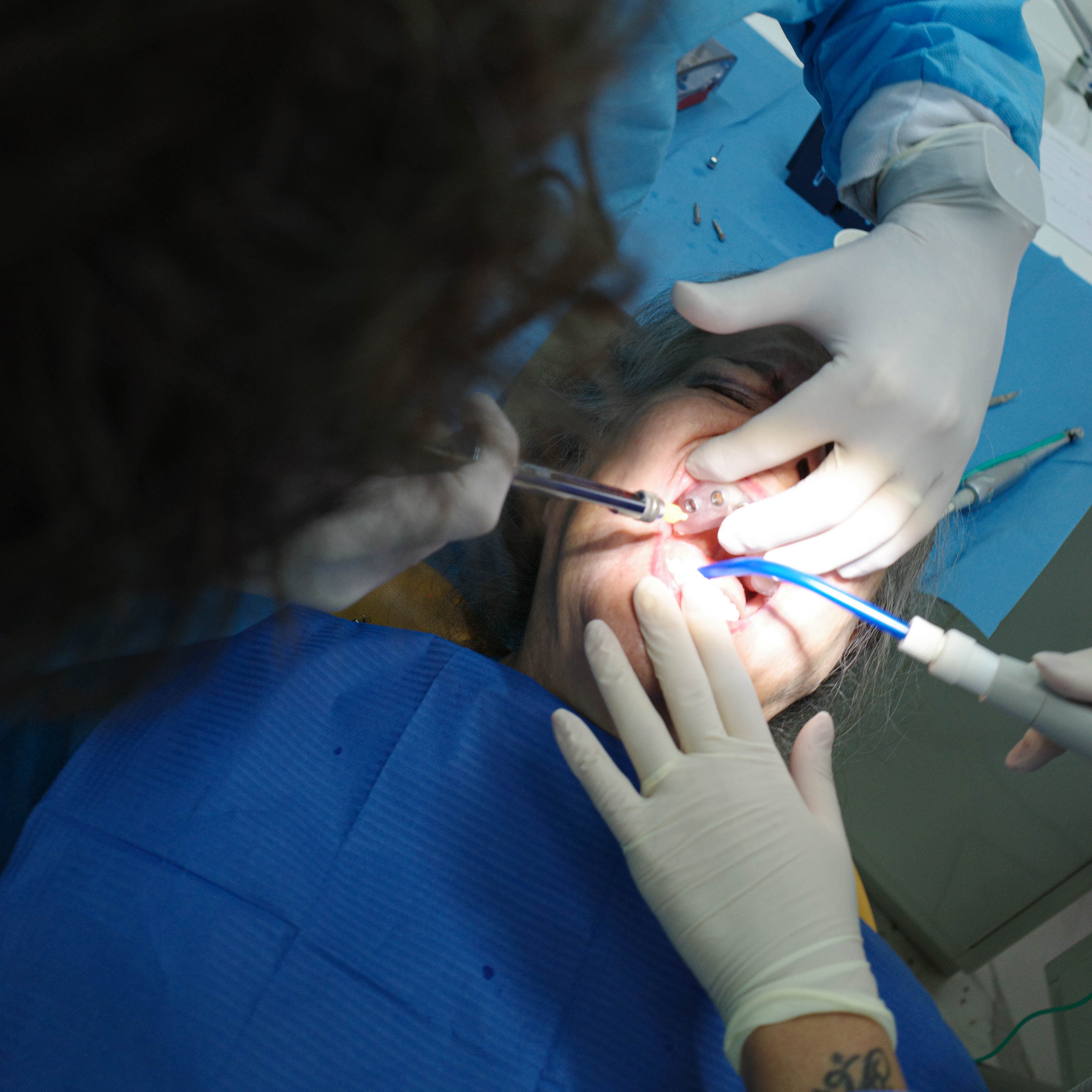 Impianti dentali in centro a Milano