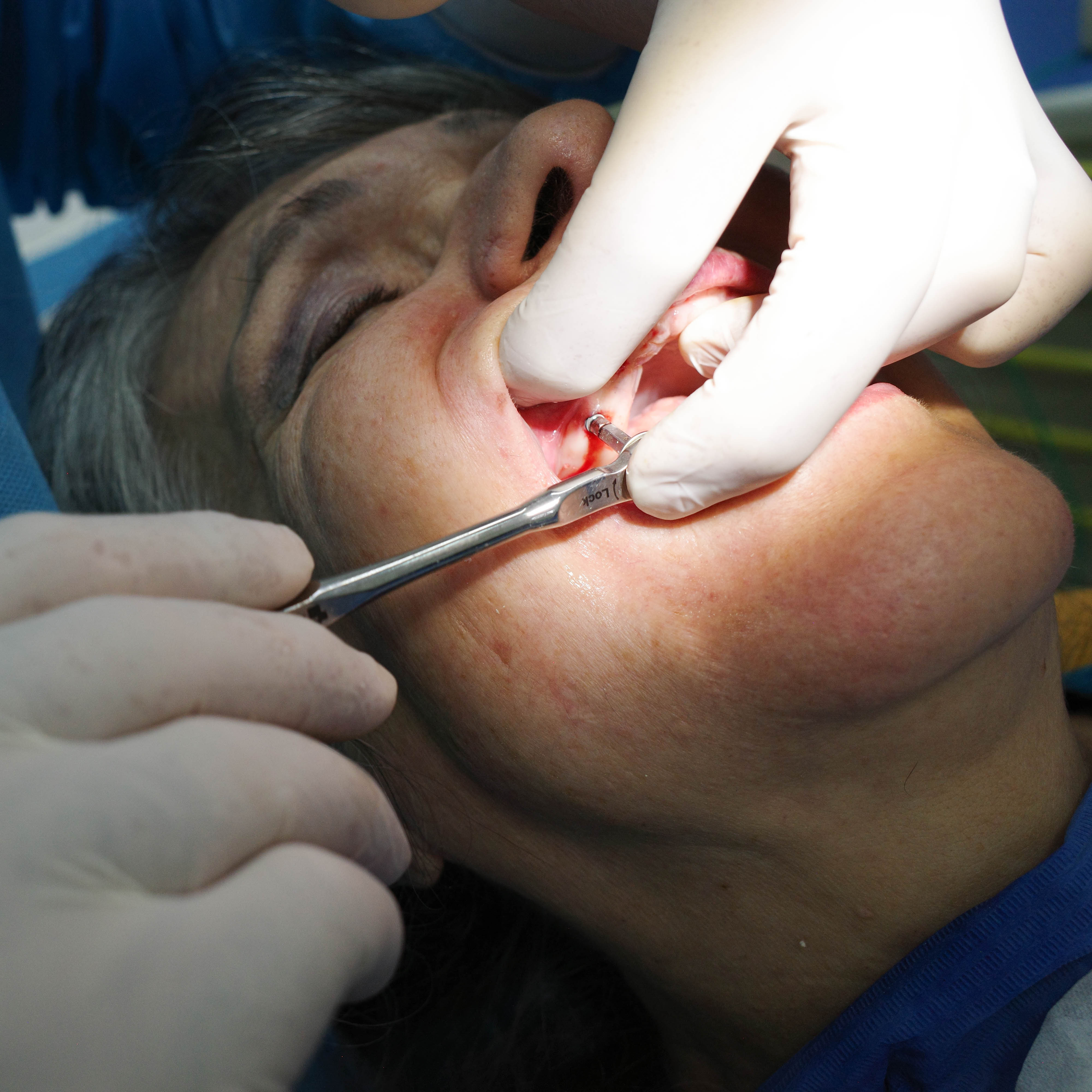 Impianti dentali in centro a Milano