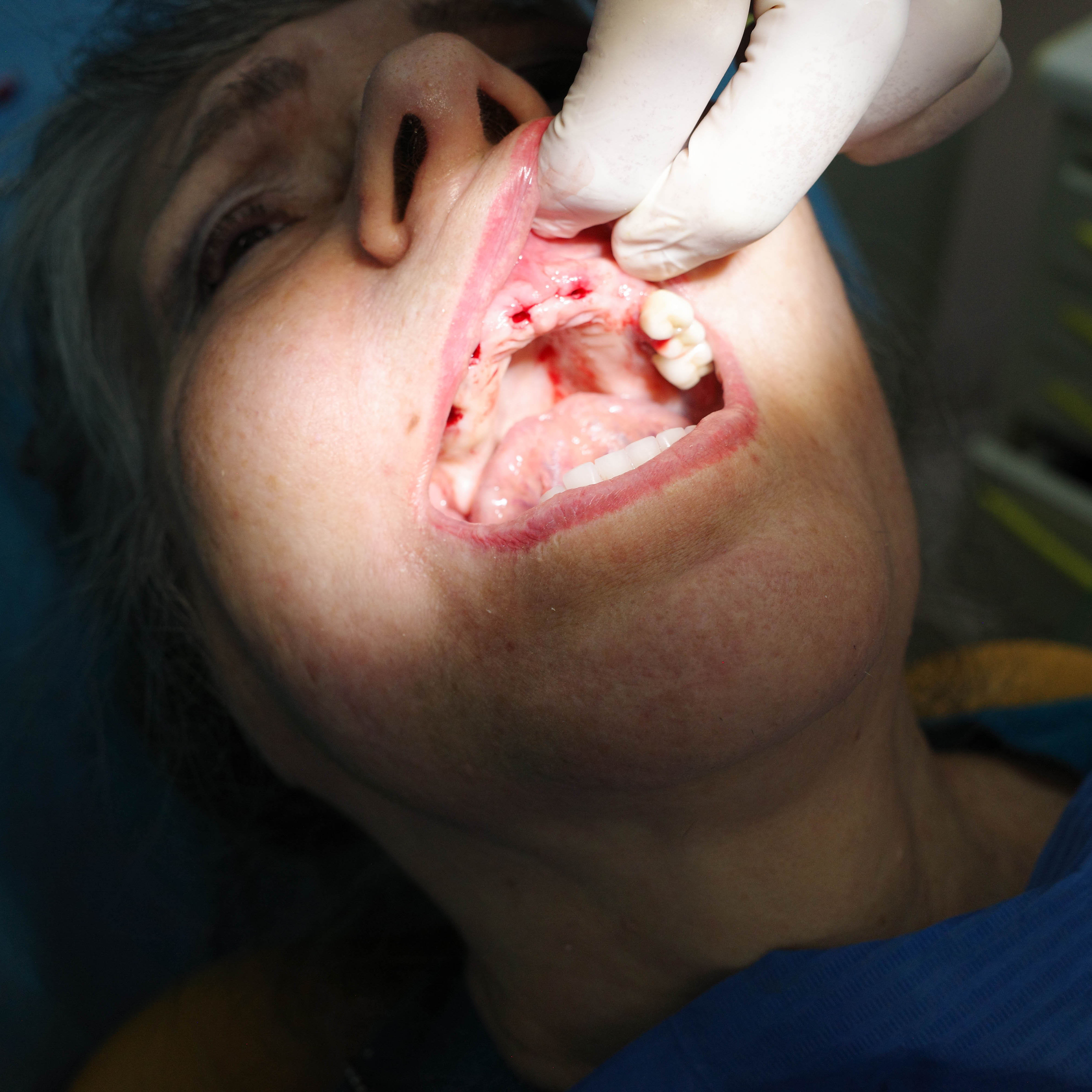 Impianti dentali in centro a Milano