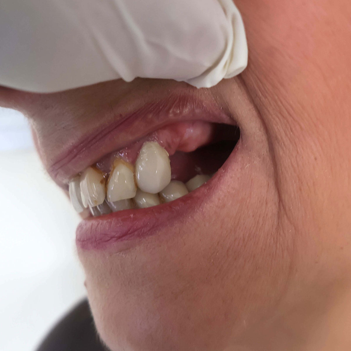 Impianti dentali in centro a Milano