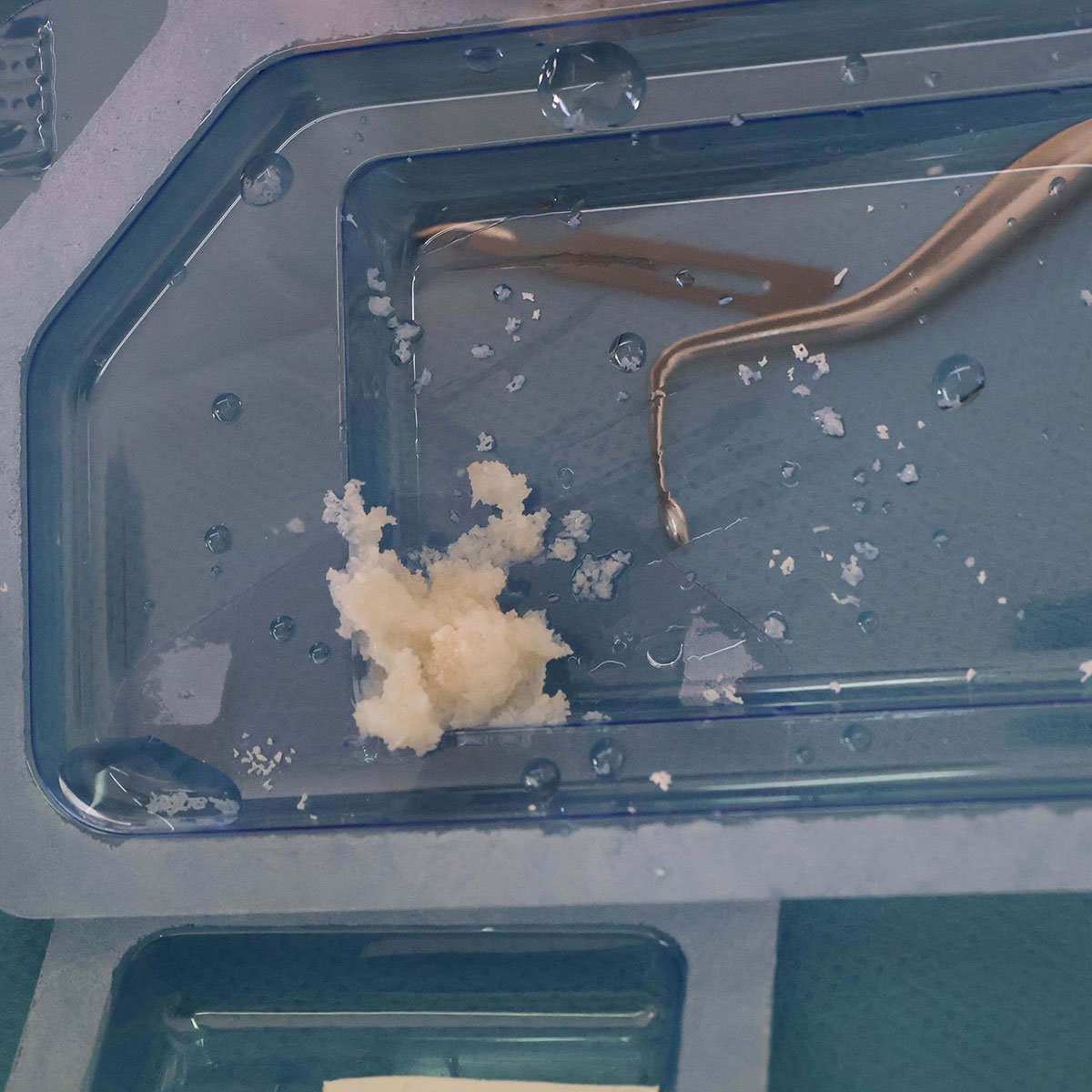 Impianti dentali in centro a Milano