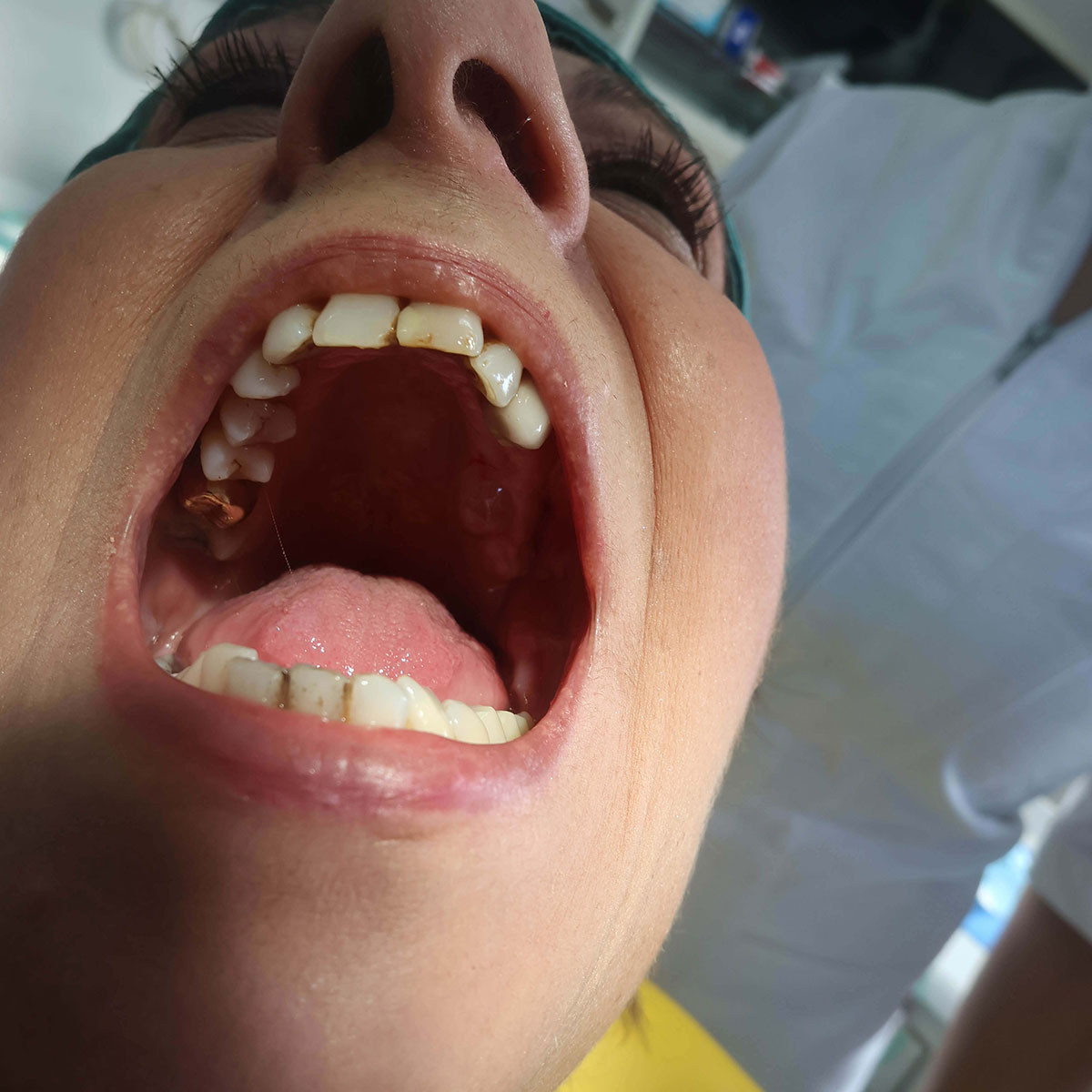 Impianti dentali in centro a Milano