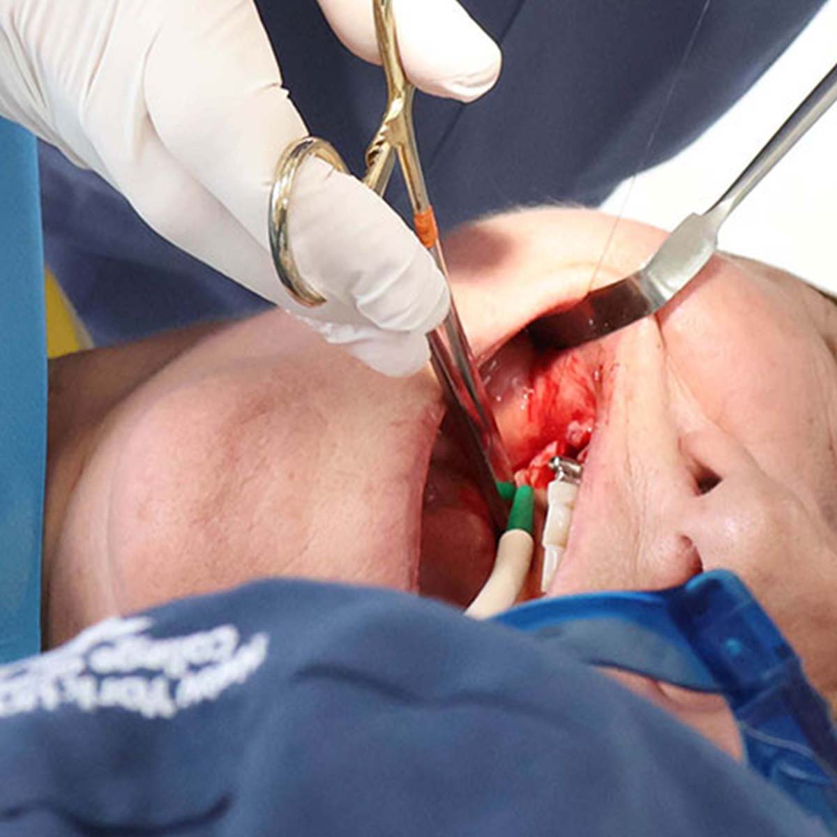 Impianti dentali in centro a Milano