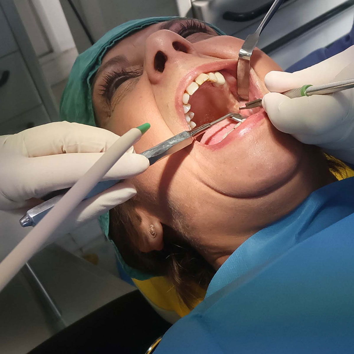 Impianti dentali in centro a Milano