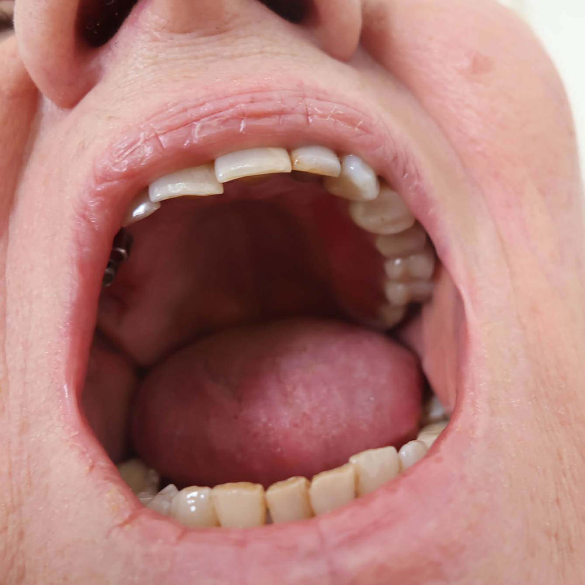 Impianti dentali in centro a Milano