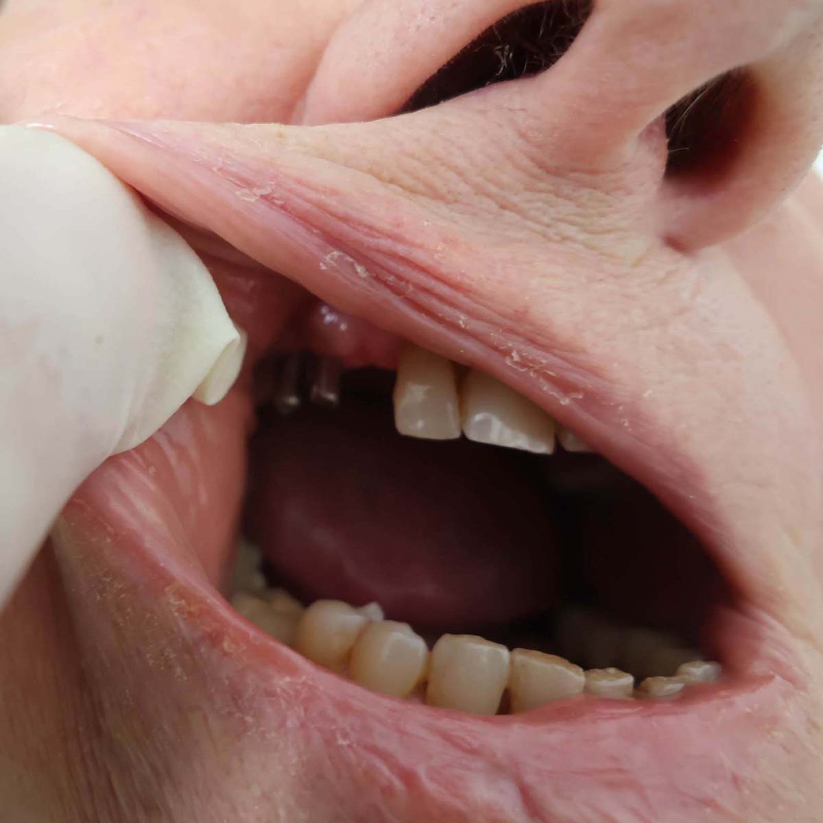 Impianti dentali in centro a Milano