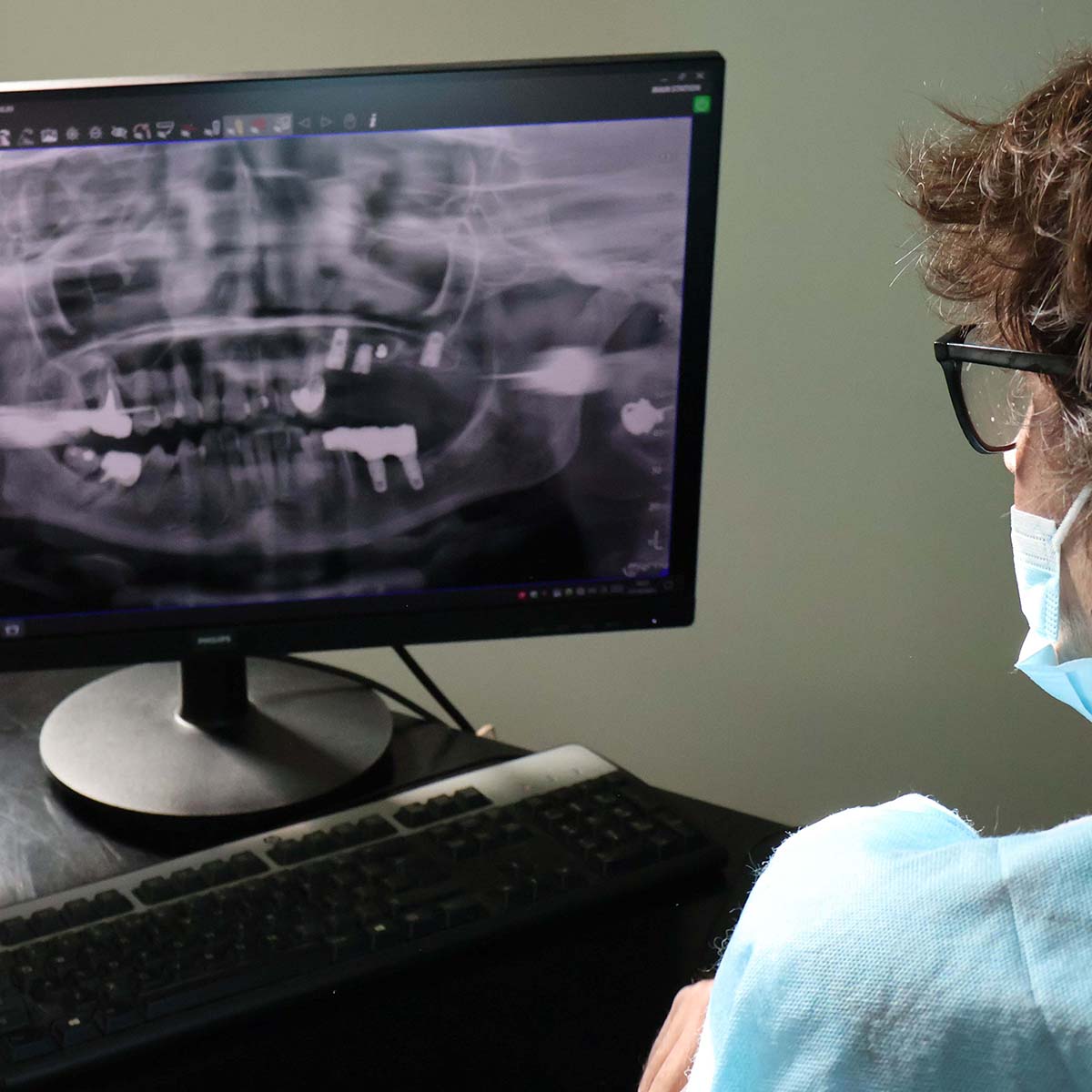 Impianti dentali in centro a Milano