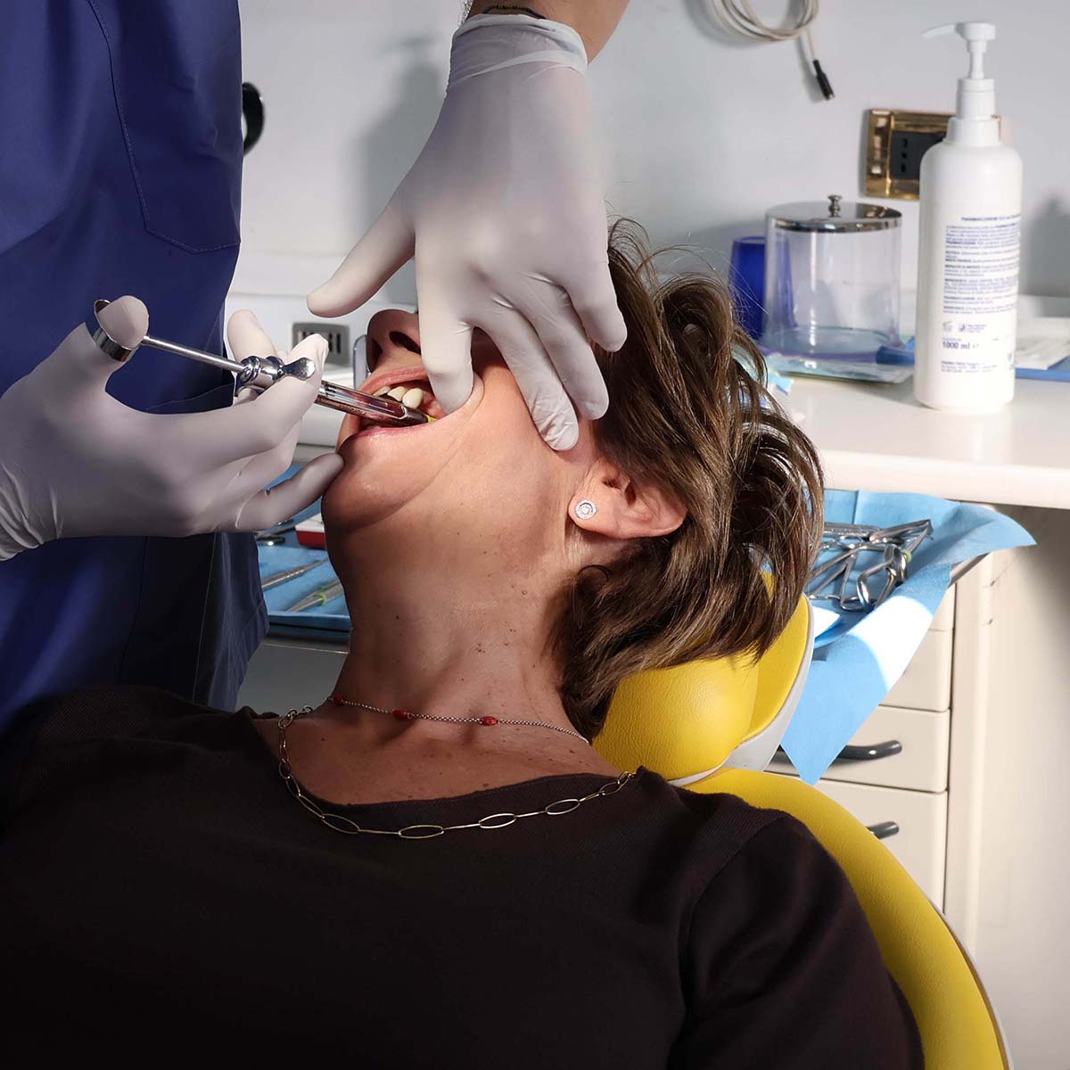 Impianti dentali in centro a Milano