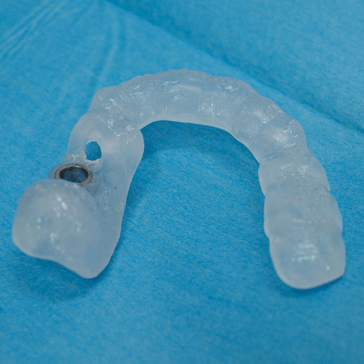 Impianti dentali in centro a Milano