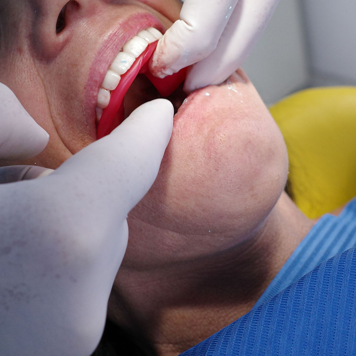 Impianti dentali in centro a Milano