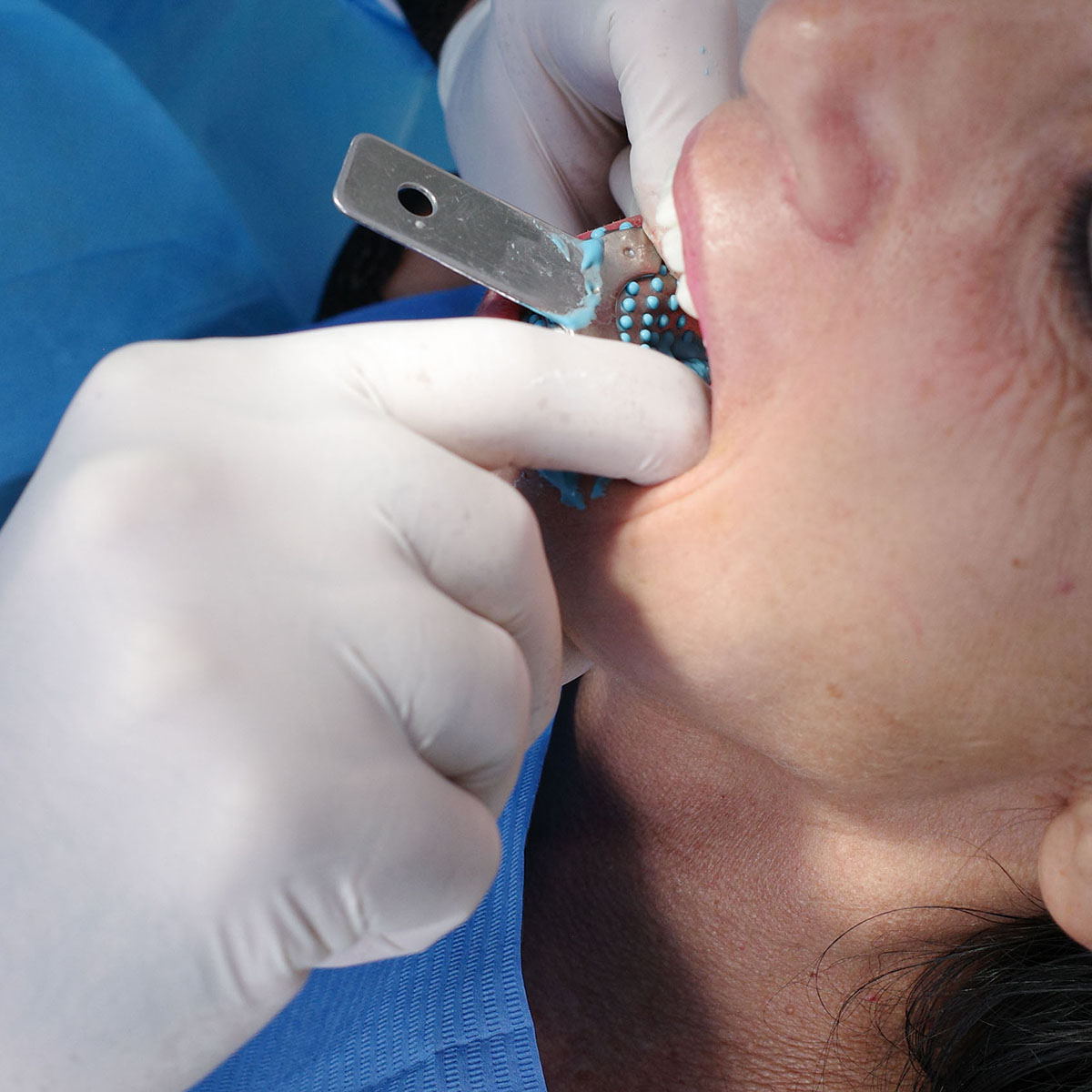 Impianti dentali in centro a Milano
