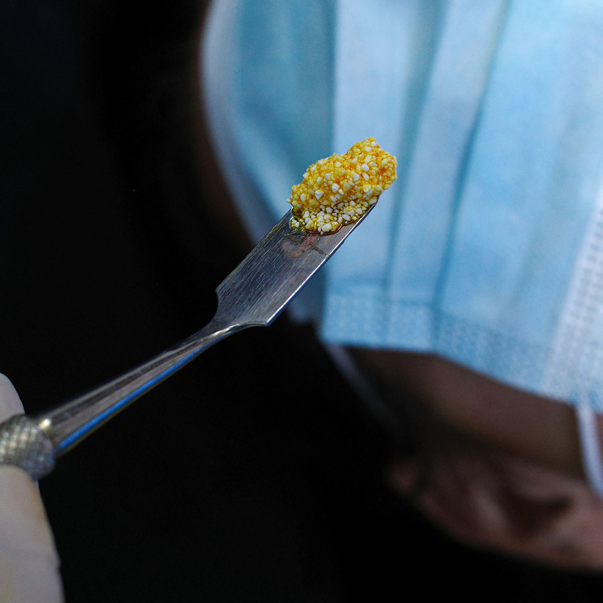 Impianti dentali in centro a Milano