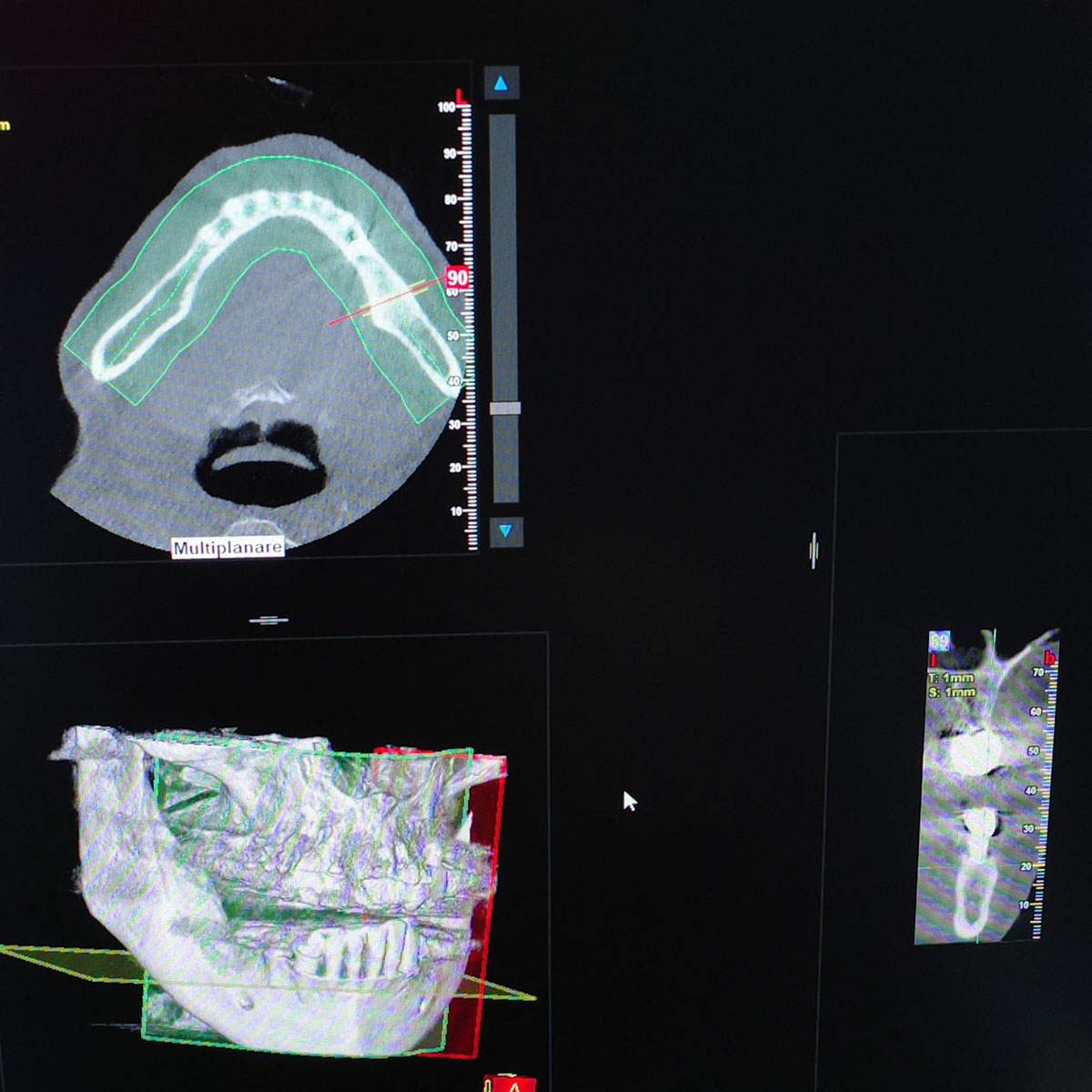 Impianti dentali in centro a Milano