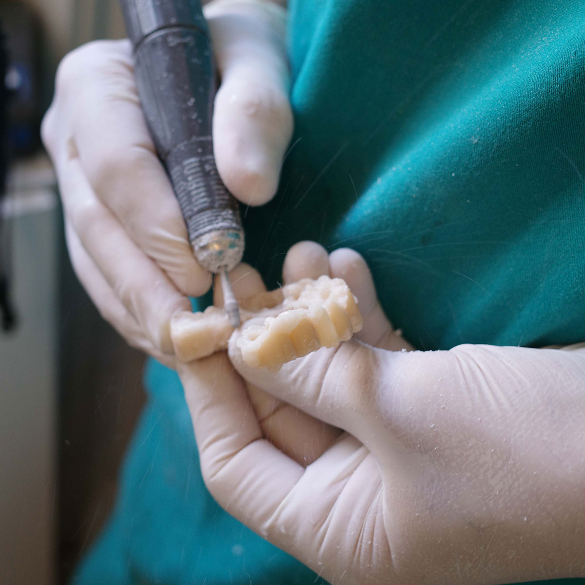 Impianti dentali in centro a Milano