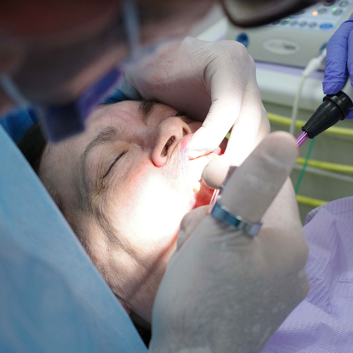 Impianti dentali in centro a Milano