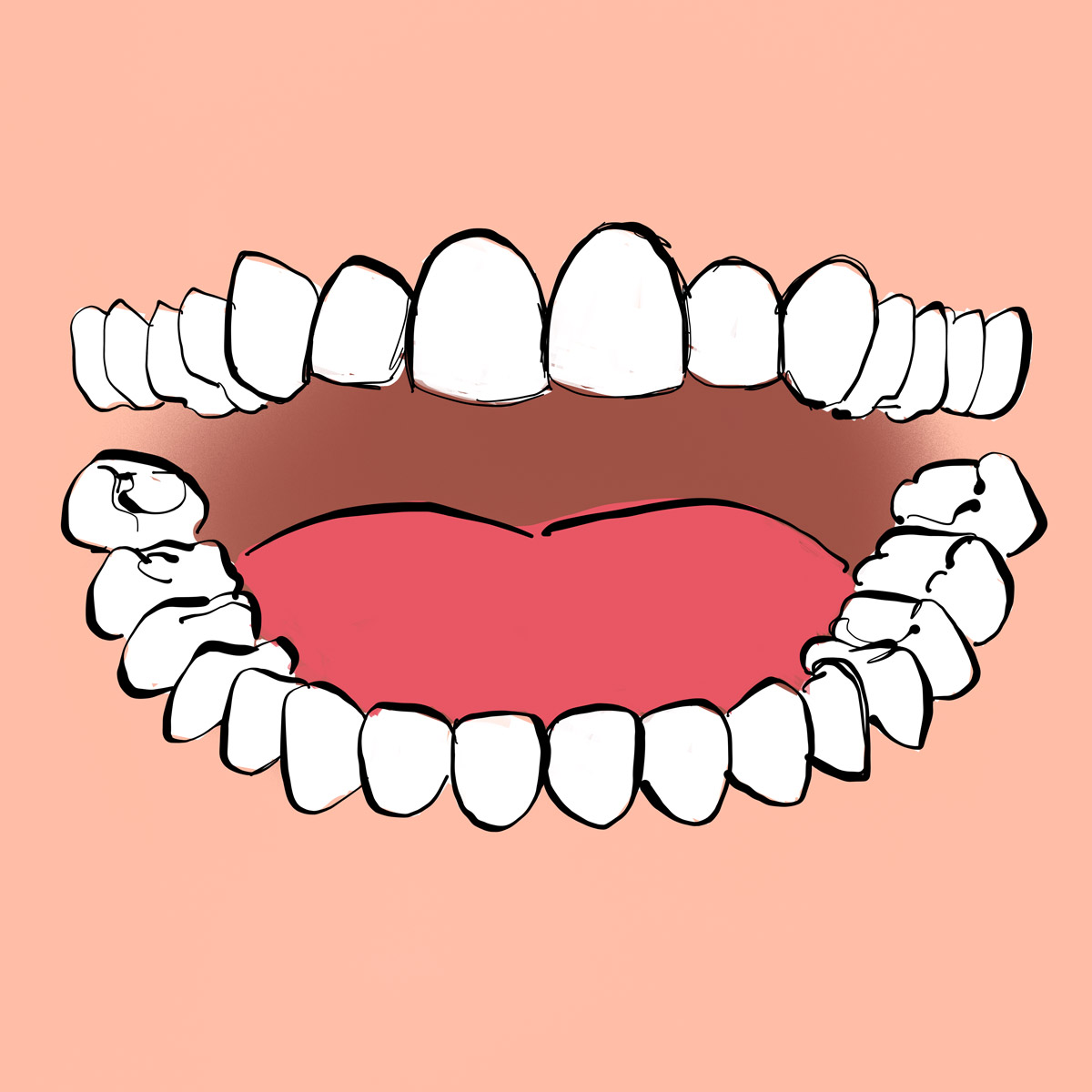 Impianti dentali in centro a Milano