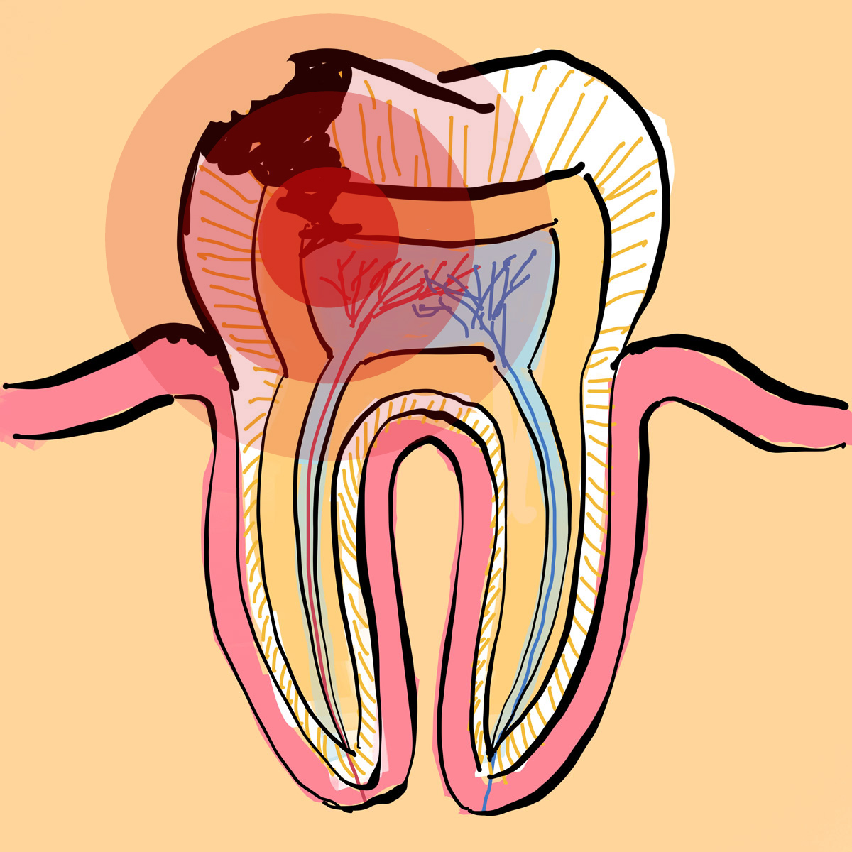 Impianti dentali in centro a Milano