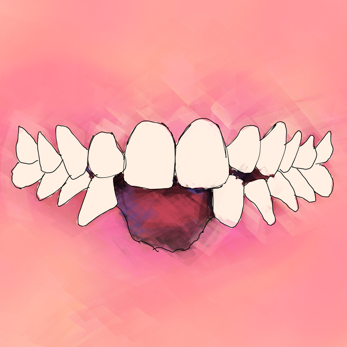 Impianti dentali in centro a Milano