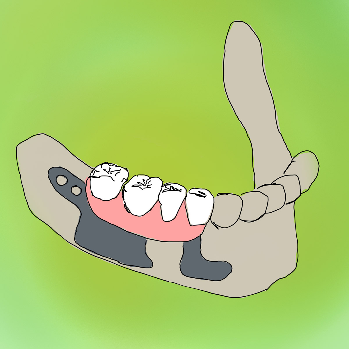 Impianti dentali in centro a Milano