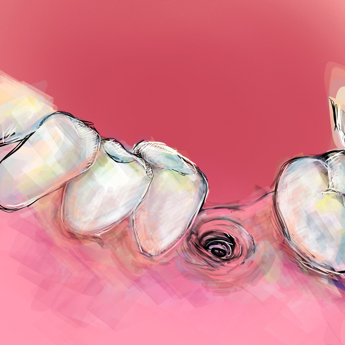 Impianti dentali in centro a Milano