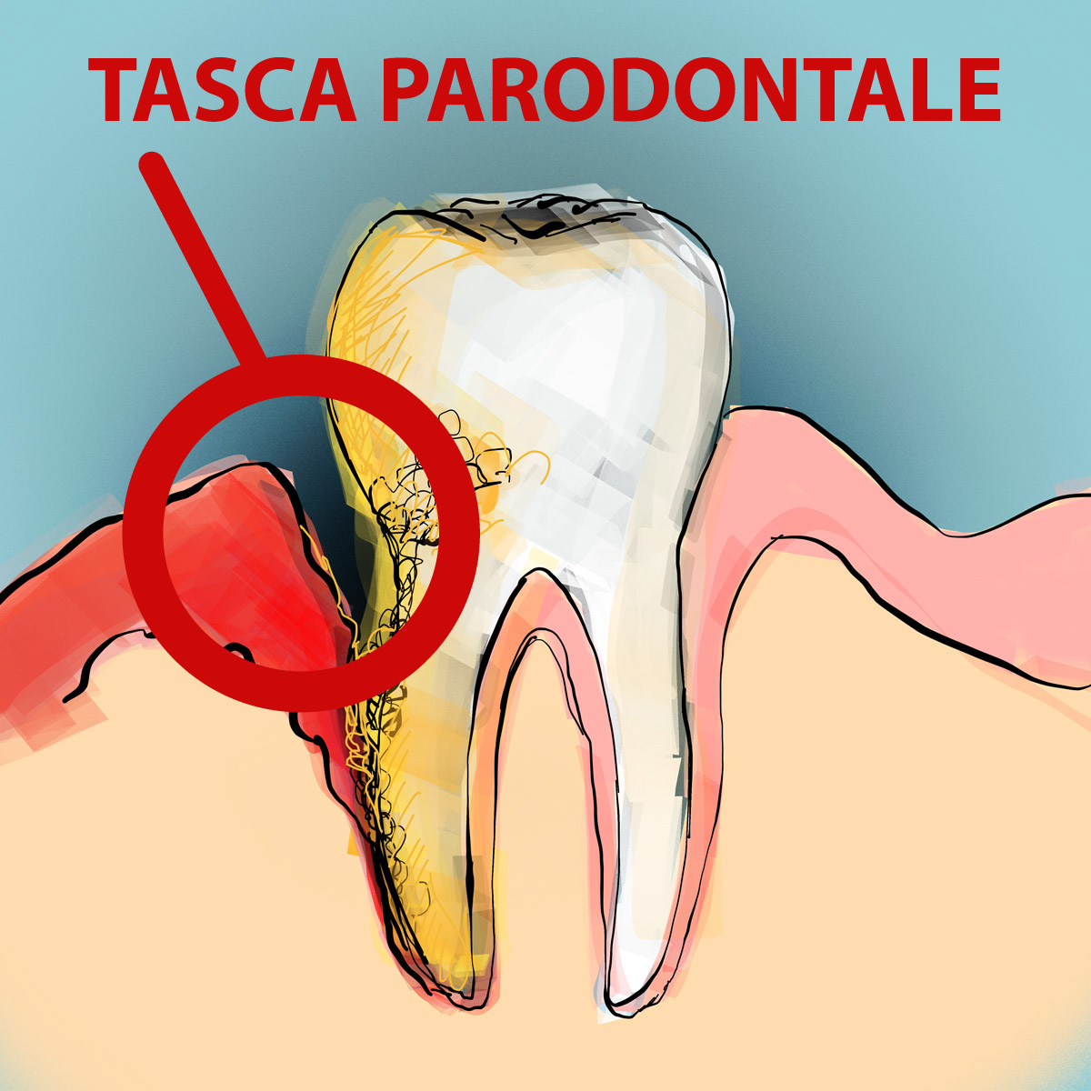 Impianti dentali in centro a Milano