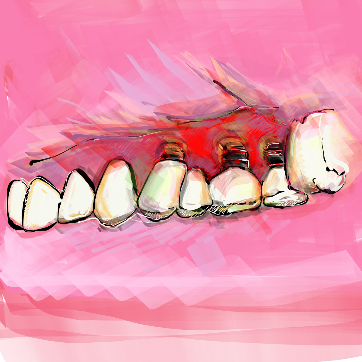 Impianti dentali in centro a Milano