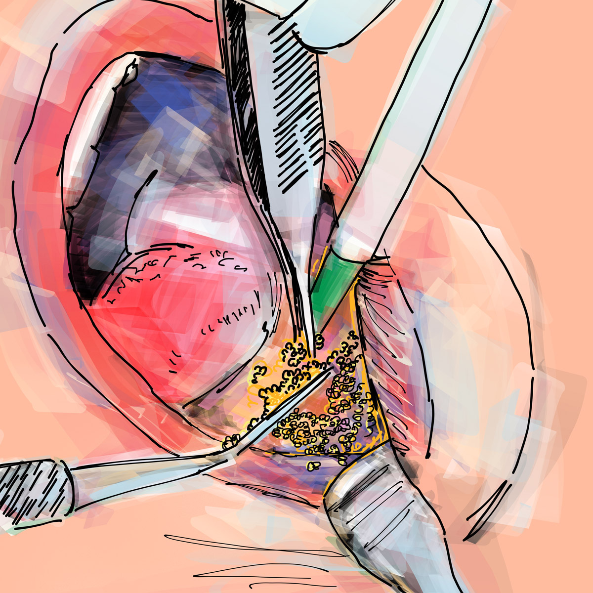 Impianti dentali in centro a Milano