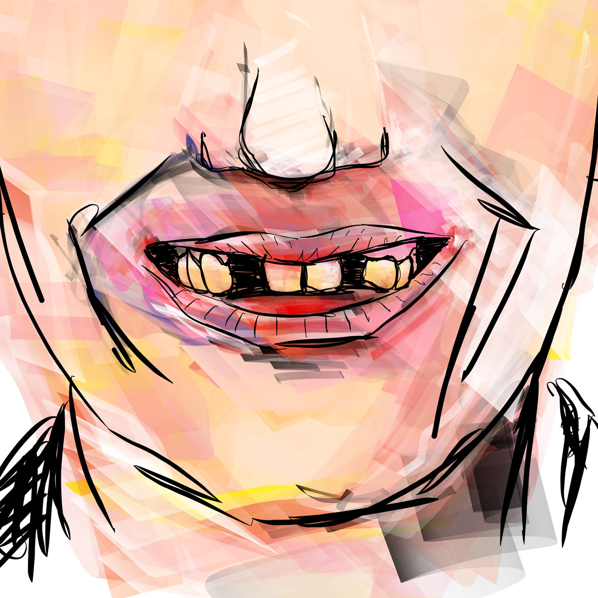 Impianti dentali in centro a Milano