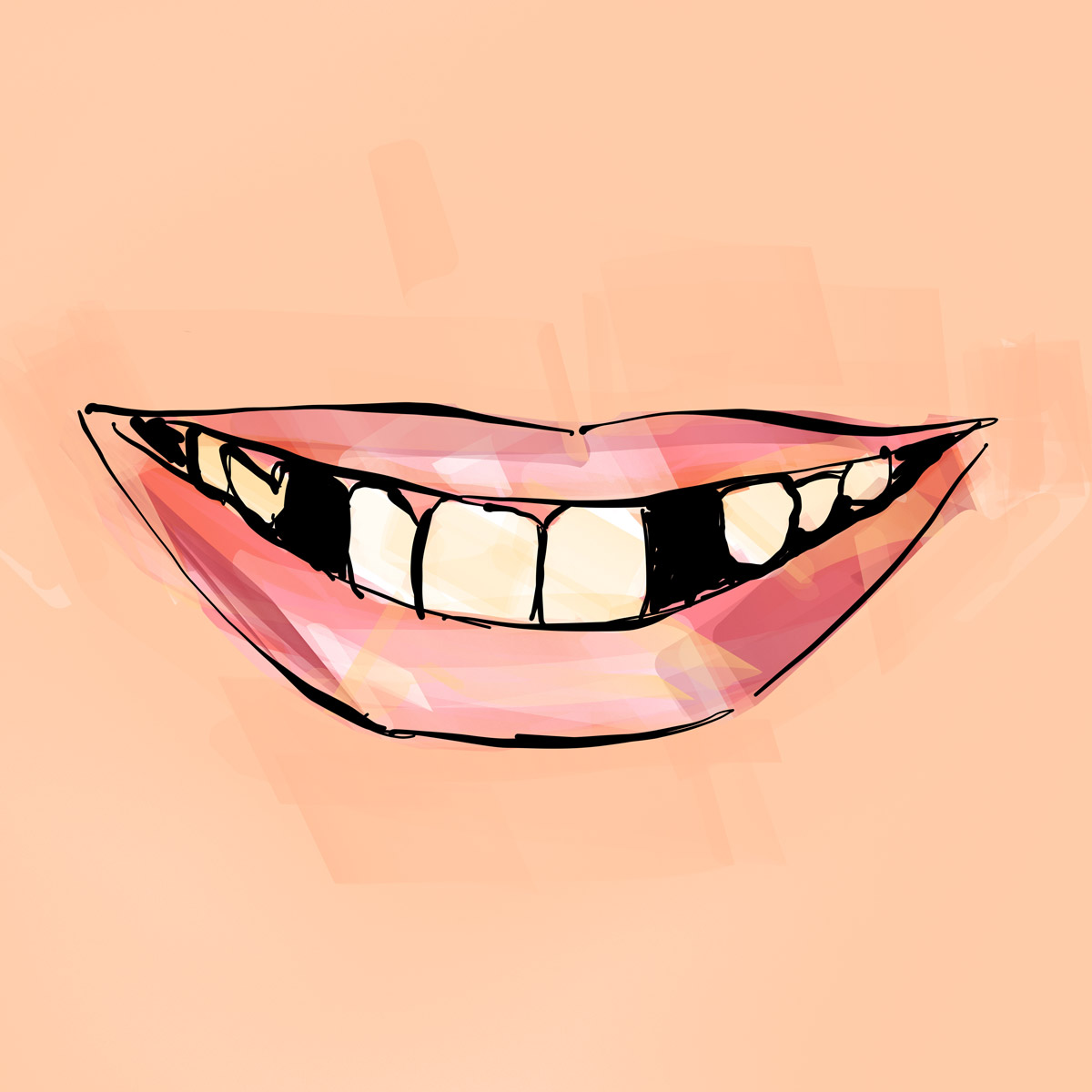 Impianti dentali in centro a Milano