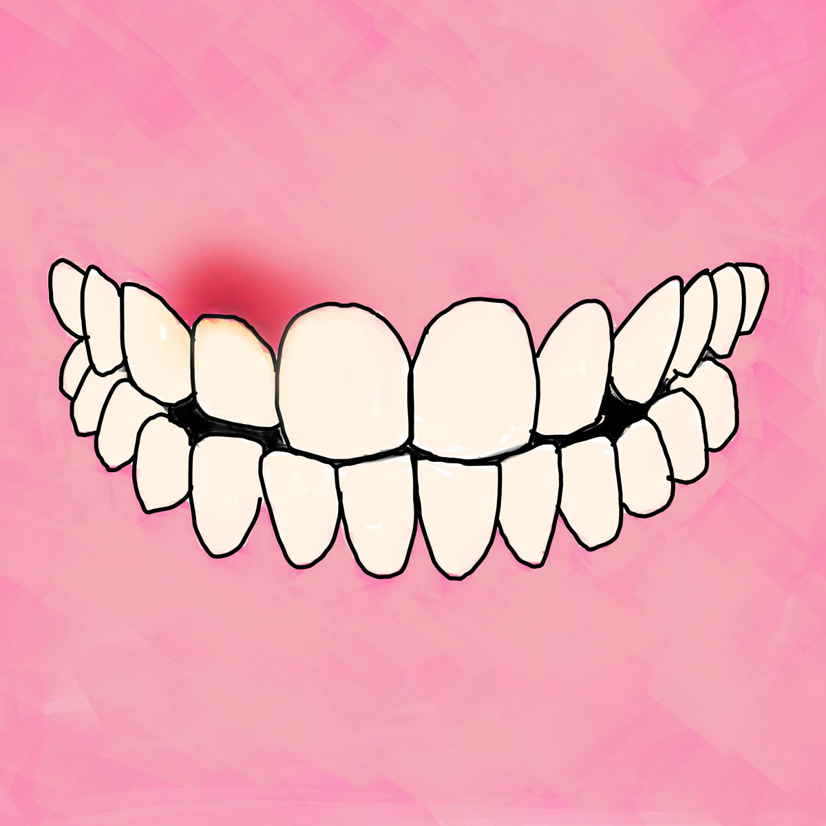 Impianti dentali in centro a Milano