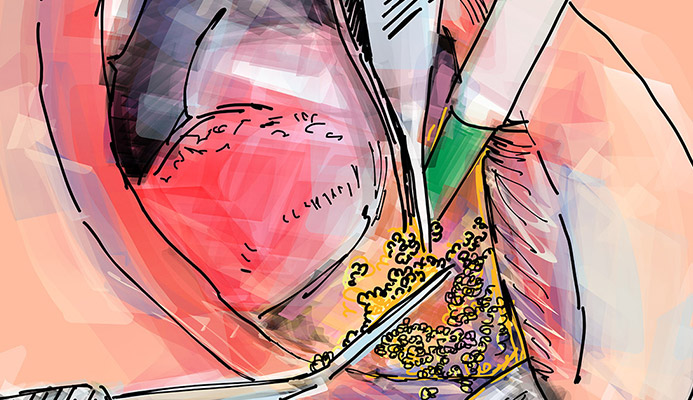 Impianti dentali in centro a Milano